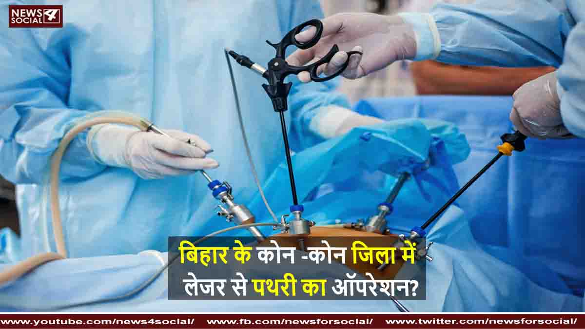 बिहार के कौन -कौन जिला में लेजर से पथरी का ऑपरेशन होता है?