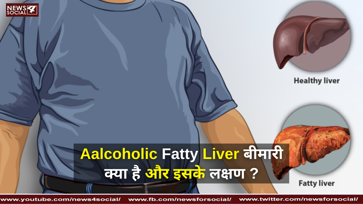 Aalcoholic Fatty Liver बीमारी क्या है और इसके लक्षण ?