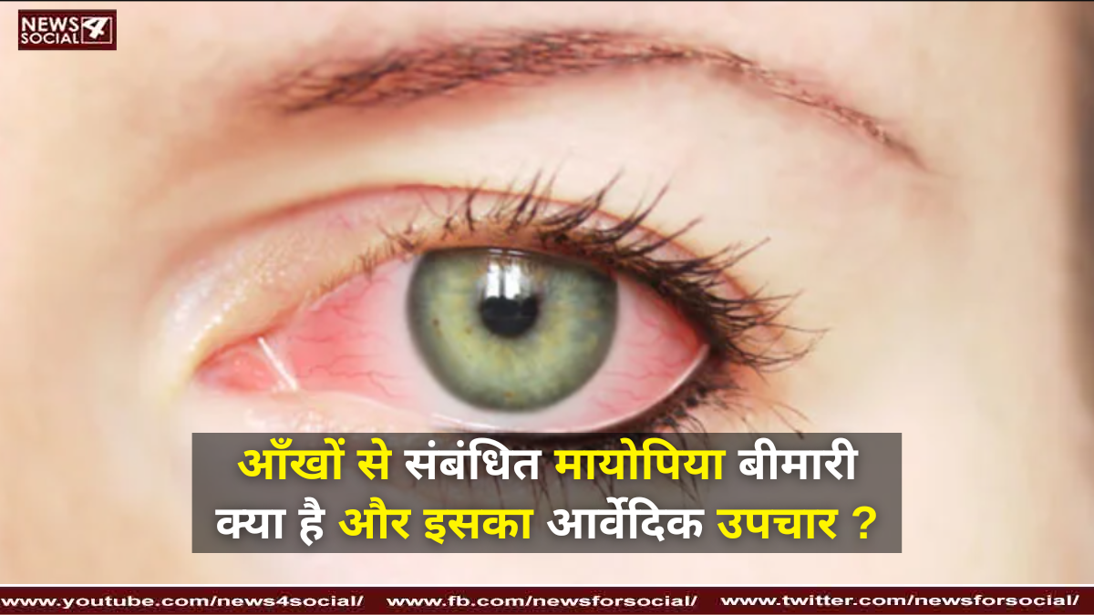 आँखों से संबंधित मायोपिया बीमारी क्या है और इसका आयुर्वेदिक उपचार ?